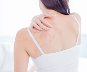 Can a Humidifier Help With Eczema