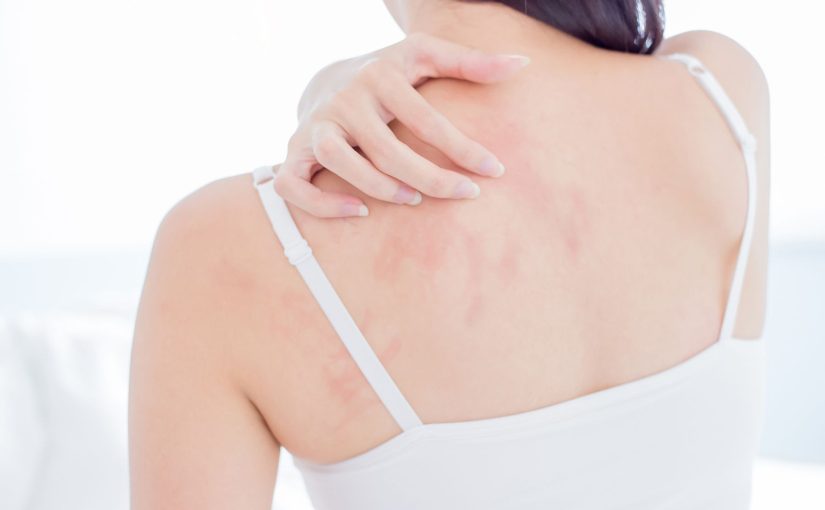 Can a Humidifier Help With Eczema?