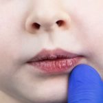 Can a Humidifier Help With Dry Mouth? Can a Humidifier Help With Dry Mouth
